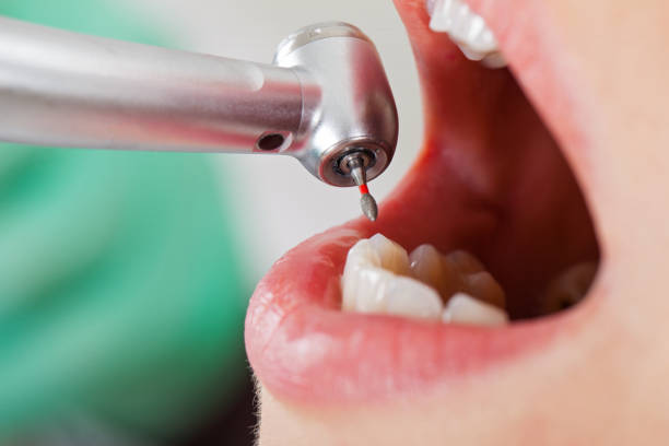 Best Emergency Broken Tooth Repair in Tennessee Ridge, TN